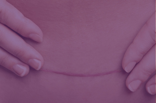 C-Section Recovery Must-Haves: How We Designed the Perfect Postpartum Underwear